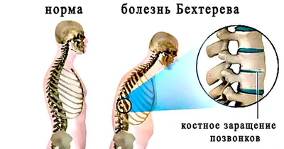 Болезни органов пищеварения