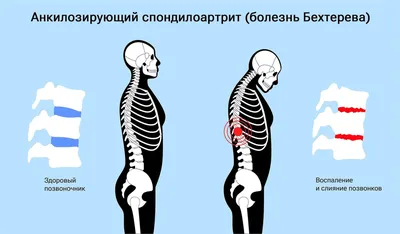 Облысение: болезни, вызывающие облысение