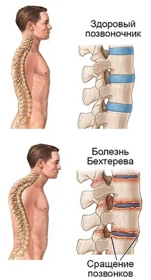 Рискнул здоровьем. Ученый испытал на себе препарат от неизлечимой болезни -  РИА Новости, 27.11.2023