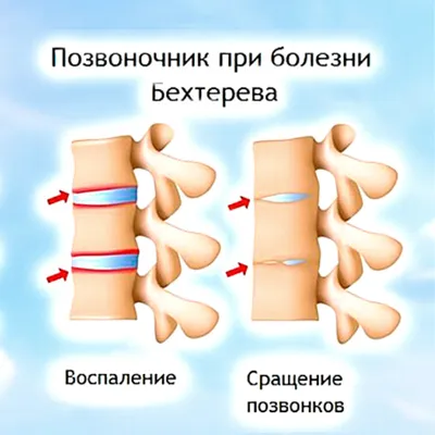 Многие даже не знают, что больны: своевременная диагностика помогает  отсрочить развитие болезни или избежать ее - Delfi RU