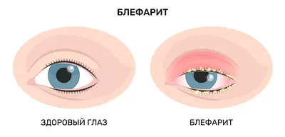 Врожденные заболевания глаз: почему возникают, какие бывают и как  устраняются - Офтальмологические клиники «Эксимер» (Киев) – диагностика и  лечение заболеваний глаз у взрослых и детей