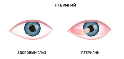 Строение глаза и его влияние на зрение | ACUVUE®