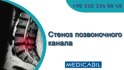 Шлюз №2 Канала имени Москвы: где находится, на карте, фото, год постройки,  как добраться, сроки работы, характеристики