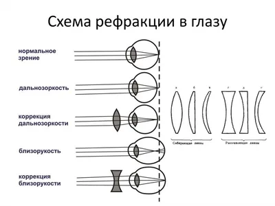 ЧОРИКУЛ ШАЙМАТОВ ГАВХАРИ - Самый интересный и доступный метод для  профилактики проблем со зрением ‼ Читайте и сохраняйте, пробуйте 😉  Излишнее напряжение в глазах приводит к различным расстройствам зрения.  Чтобы это предотвратить,