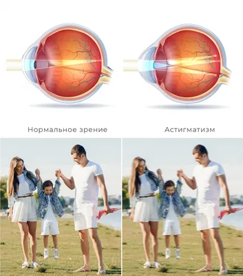 3D изображения