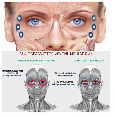 Крутые капли для глаз, 15 мл, медицинское Средство Для Расслабления Глаз,  массажа, ухода за глазами, продукты для здоровья, Детокс, снимает  дискомфорт, избавляет от усталости | AliExpress