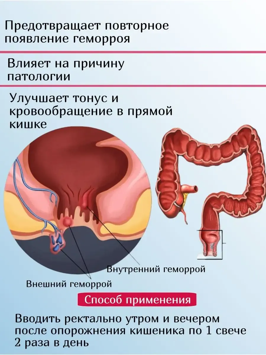 Показать Картинки Геморроя