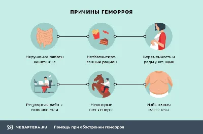 9 методов лечения геморроя у женщин и мужчин: рейтинг, отзывы, советы врачей