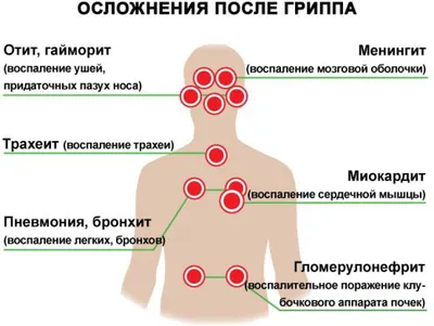 Об основных мерах профилактики гриппа и ОРВИ – Новости – Окружное  управление социального развития (Сергиево-Посадского городского округа)