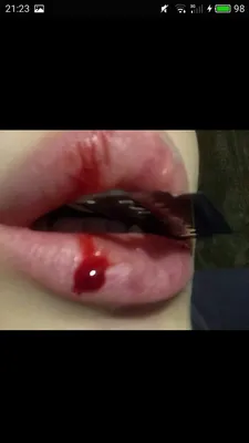 [39+] Картинки губы в крови обои