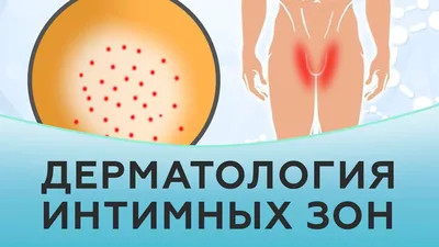 Для отбеливания подмышек интимных мест, крем от темной кожи от темных  пятен, лица и тела для осветления интимной зоны (30 мл) - купить с  доставкой по выгодным ценам в интернет-магазине OZON (1123765180)