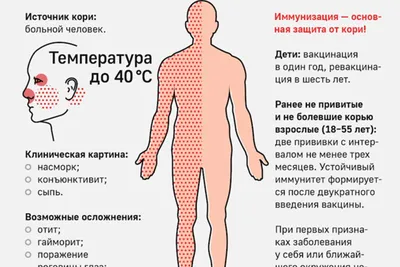 Двое детей умерли от кори в Казахстане