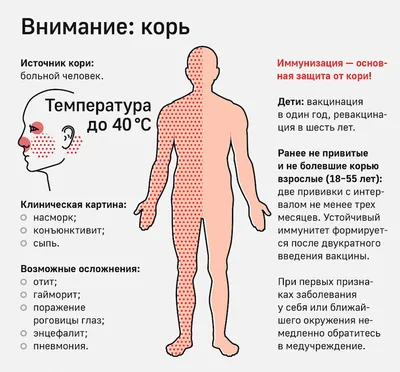 Более 140 случаев кори зарегистрировано за год в Беларуси, большинство  заболевших не привиты — Бобруйский новостной портал Bobrlife