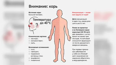 Полугодовалый ребенок умер от кори в Восточном Казахстане - Телеканал  «Астана»