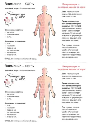 Вспышку кори выявили в нескольких регионах России. Для кого болезнь  смертельна | Ямал-Медиа