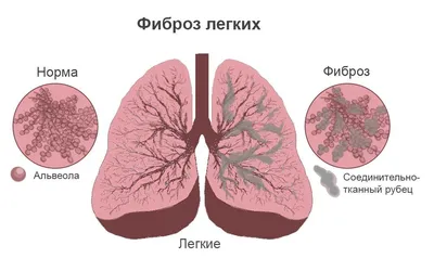 Легкие рисунки карандашом для начинающих love легкие (44 фото) » рисунки  для срисовки на Газ-квас.ком