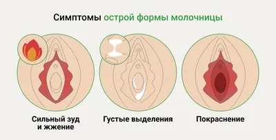 Картинки молочницы у женщин