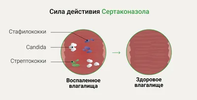 Лекарства от молочницы - купить препарат от молочницы в Украине | Цены в  МИС Аптека 9-1-1