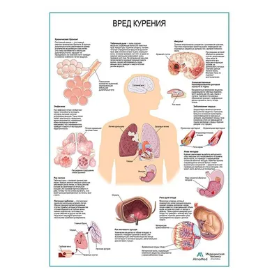 Вред курения плакат глянцевый А1+/А2+ › Купить оптом и в розницу › Цена от  завода