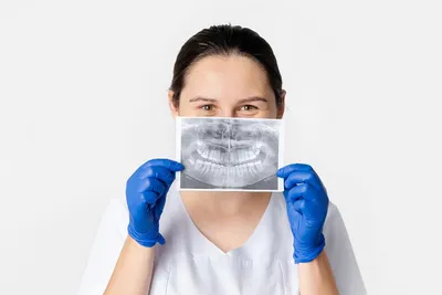 Какой способ протезирования зубов применяют при пародонтозе