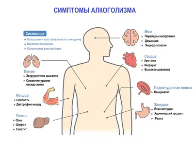 Все ли выпивающие становятся алкоголиками? | Бросаем пить вместе | Дзен