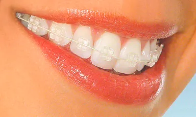 Молочные зубы: лечить или удалять – статьи детской стоматологической  клиники «Мартинка»