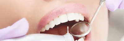 здоровые зубы стоковое изображение. изображение насчитывающей кожа - 4412345