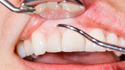 Качество жизни: здоровые зубы — подарок судьбы или заслуга человека? |  Posta-Magazine