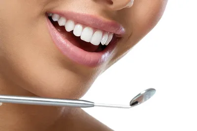 Красивые зубы – как сделать ровные, белые зубы и сколько стоит идеальная  улыбка?