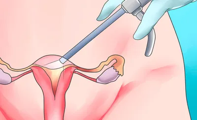 Анатомия и физиология женской половой системы - презентация онлайн