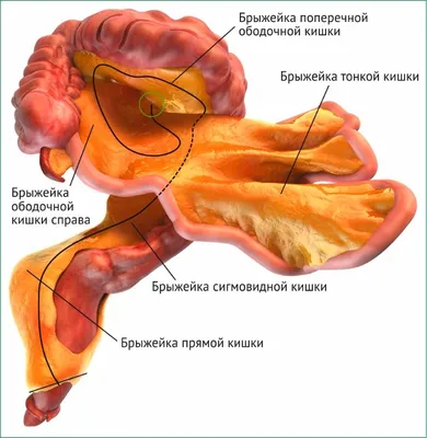 Крона болезнь кишечника медицина схема анатомия человека Handdraw векторные  иллюстрации PNG , кишечник, болезнь Крона, схема PNG картинки и пнг рисунок  для бесплатной загрузки