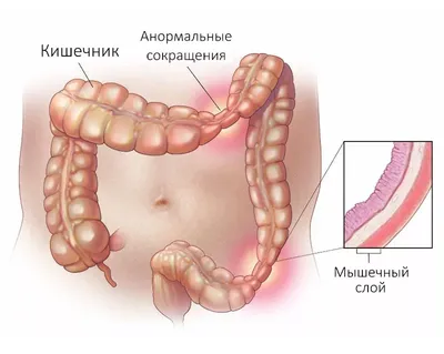 Человеческий орган кишечник красная кишка красивая кишка нарисованная  вручную кишка PNG , иллюстрация, кишечник человеческого органа, украшение  кишечника PNG картинки и пнг PSD рисунок для бесплатной загрузки