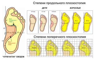 Вместо борьбы с плоскостопием я развивал свою стопу. Делюсь упражнениями  для гибкости стоп | Главврач | Дзен