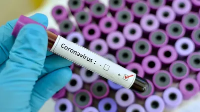 Coronavirus: no evidence that food is a source or transmission route | EFSA