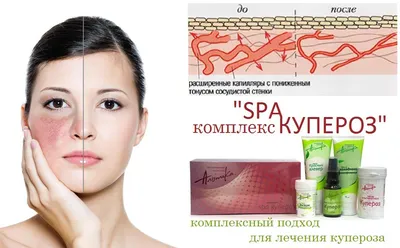 DERMAQUEST » Купероз и пигментация летом: что делать| Статьи | Отзывы |  Купить