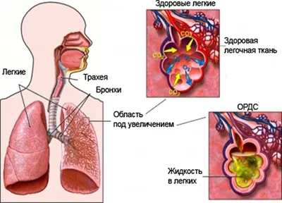 человеческого дыхательной системы PNG , респираторный, бронхи, легкие PNG  картинки и пнг рисунок для бесплатной загрузки