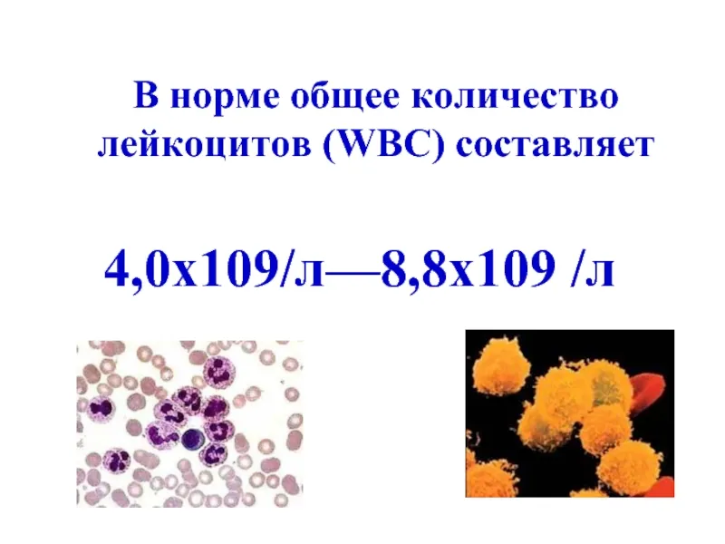 Лейкоциты количество. Общее количество лейкоцитов WBC. ВБС лейкоциты. Норма лейкоцитов в крови WBC. Абсолютное число лейкоцитов.