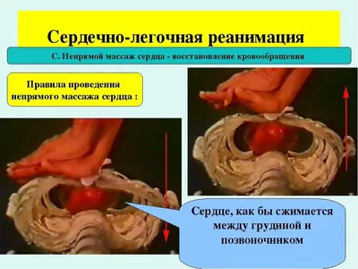 Алгоритм действия при сердечно легочной реанимации | ВСЕ ОБО ВСЕМ | Дзен