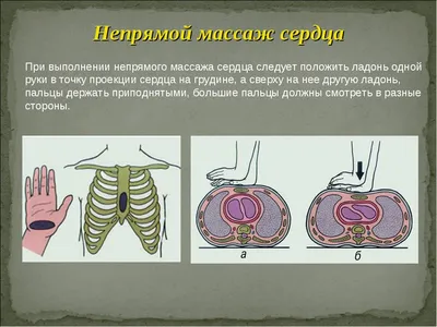 Ивановские мобилизованные научились делать искусственное дыхание и непрямой  массаж сердца