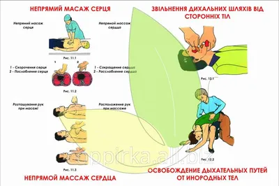 Короткие памятки по СЛР | Пикабу