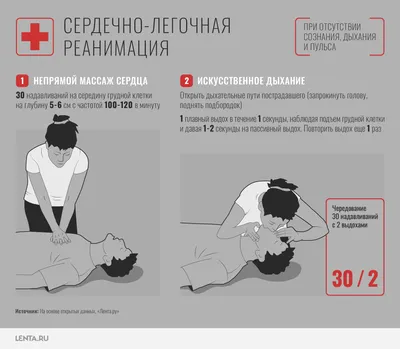 Правила оказания первой помощи: инфаркт, переломы, отравления, остановка  сердца: Уход за собой: Забота о себе: Lenta.ru