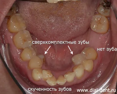 Первая стоматологическая помощь - Стоматология Ренессанс Дент