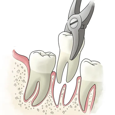 Анатомия зубов: 54 аннотированные иллюстрации | e-Anatomy