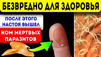 ВНИМАНИЕ! ЭНТЕРОБИОЗ! - БСМП Гродно