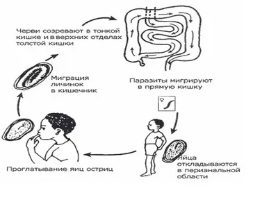 острицы- один из наиболее распространённых кишечных гельминтов . | TikTok