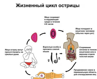 Острицы: какие признаки, что делать? | МедИнфо | Дзен