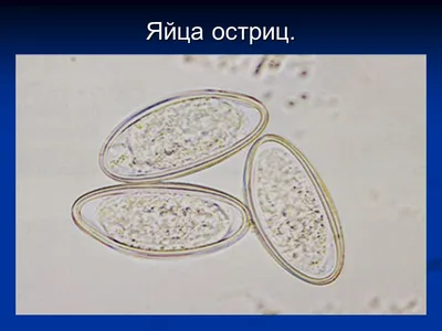 Профилактика энтеробиоза - Официальный сайт СПб ГБУЗ \"Городская поликлиника  №77 Невского района\"