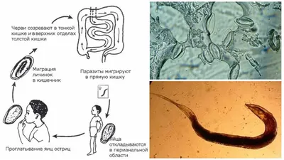 Противоглистное средство Oxford Пирантел суспензия - «Покажу как выглядят  острицы. Как мы выводили острицы. Дам советы как избавиться от глистов,  если лечение не дает эффекта. Расскажу способ как отловить остриц, если  анализ