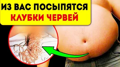 Класс Нематоды Nematoda. - ppt video online download