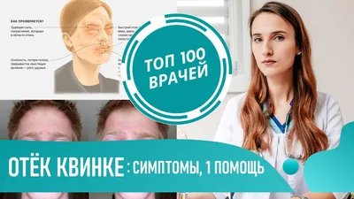 Солнечный луч - Отек Квинке – это опасное, стремительно развивающееся  состояние, связанное с реакцией иммунной системы на какой-либо  раздражитель. Развитие отека Квинке – одно из наиболее серьезных  последствий аллергии, однако он может